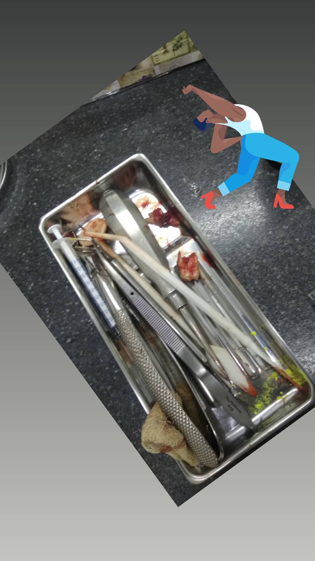 Хирургия — результат