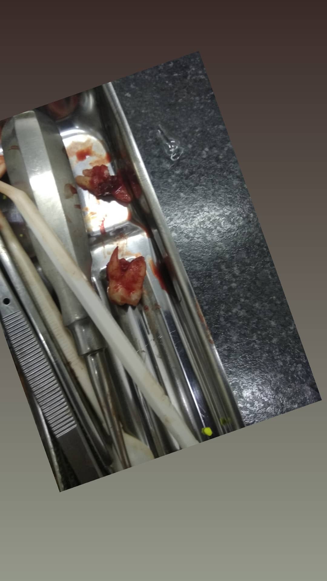 Хирургия — результат