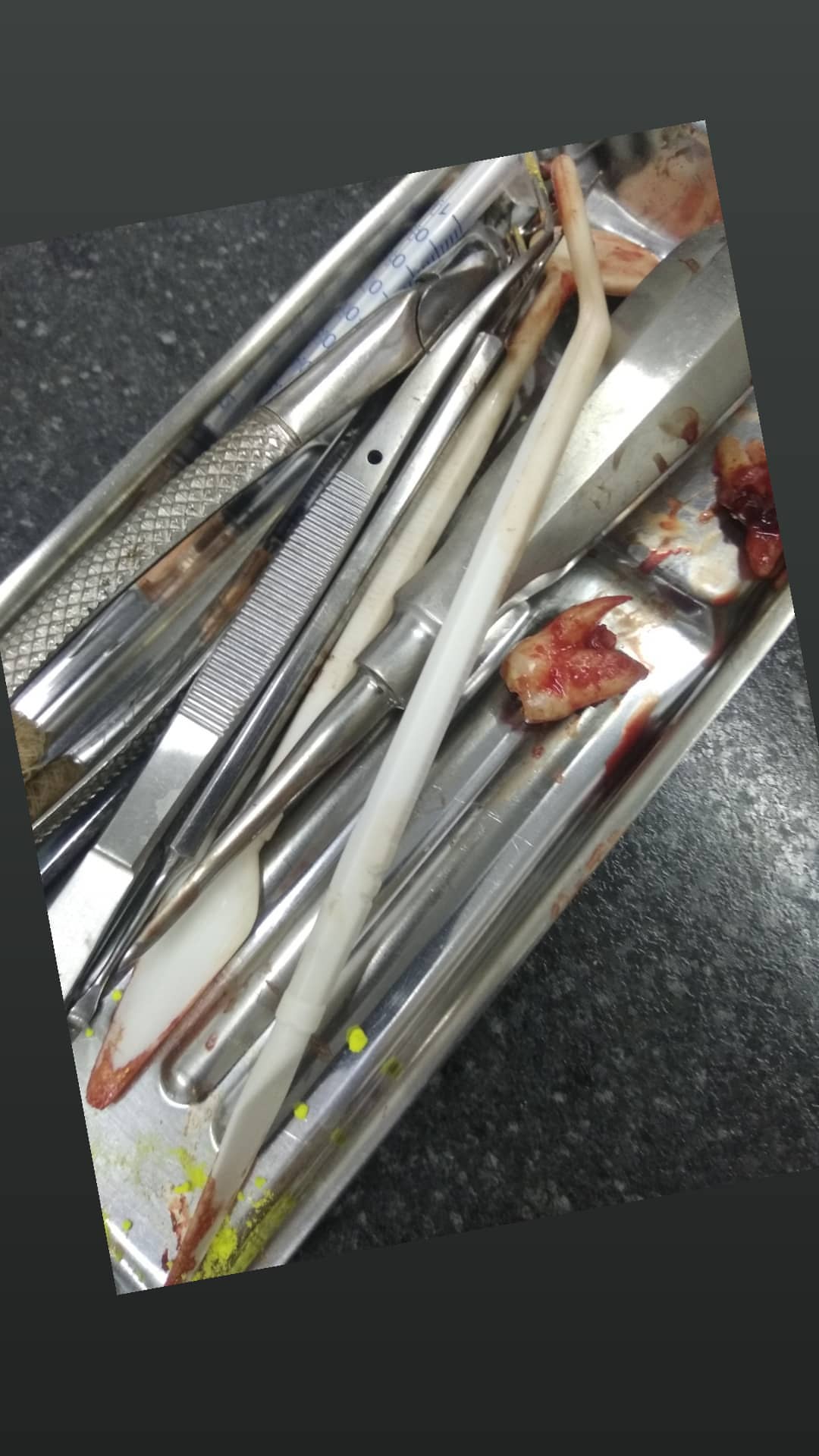 Хирургия — результат