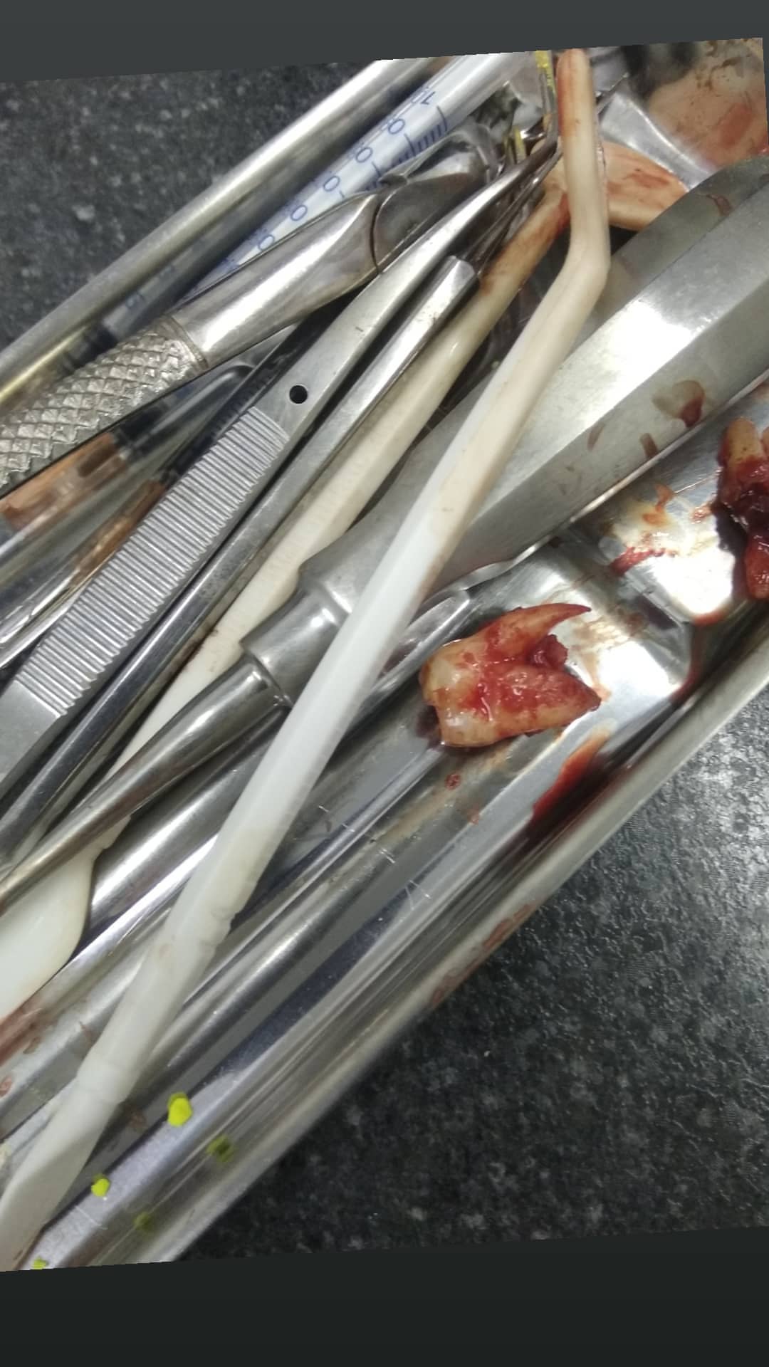 Хирургия — результат