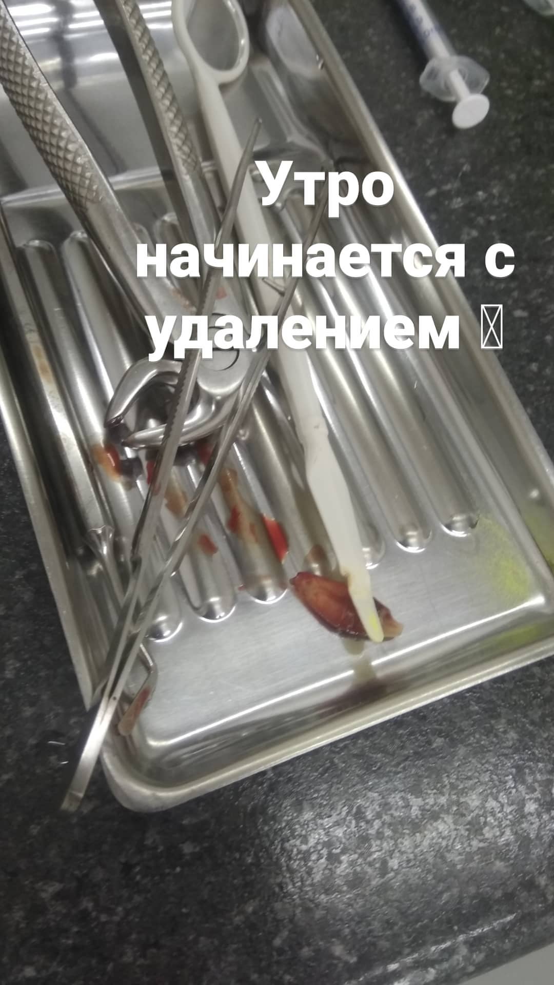 Хирургия — результат