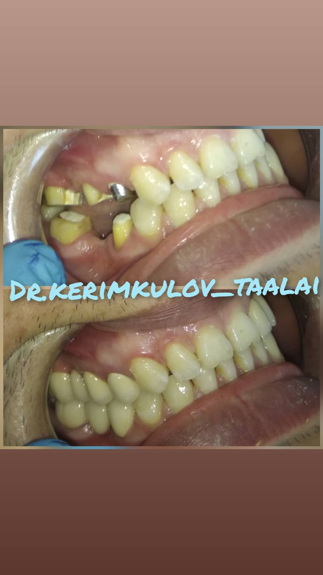 После лечения