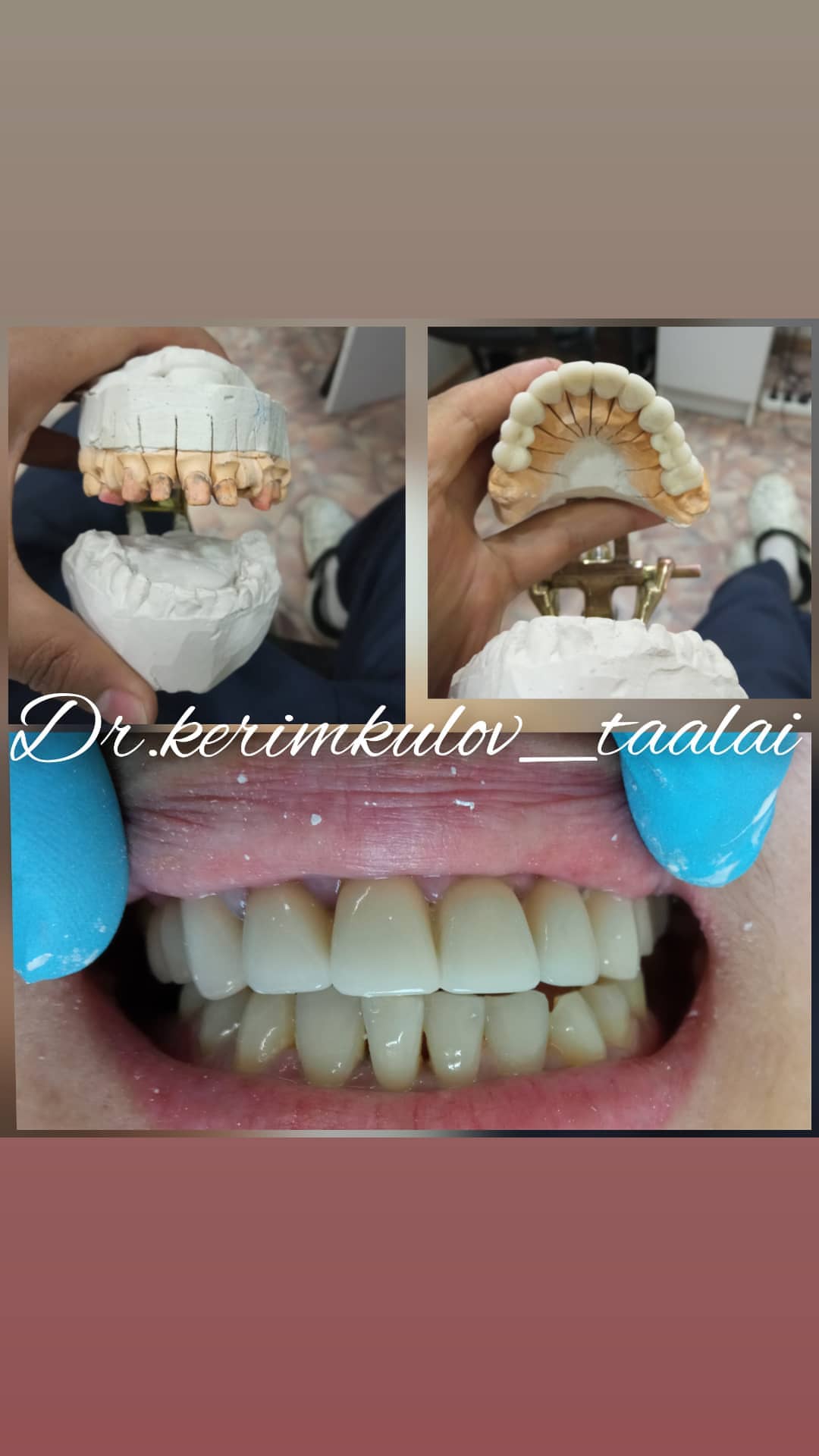 Ортопедия — результат