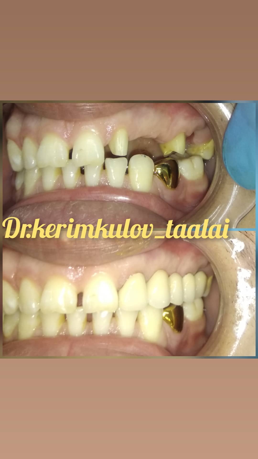 Ортопедия — результат