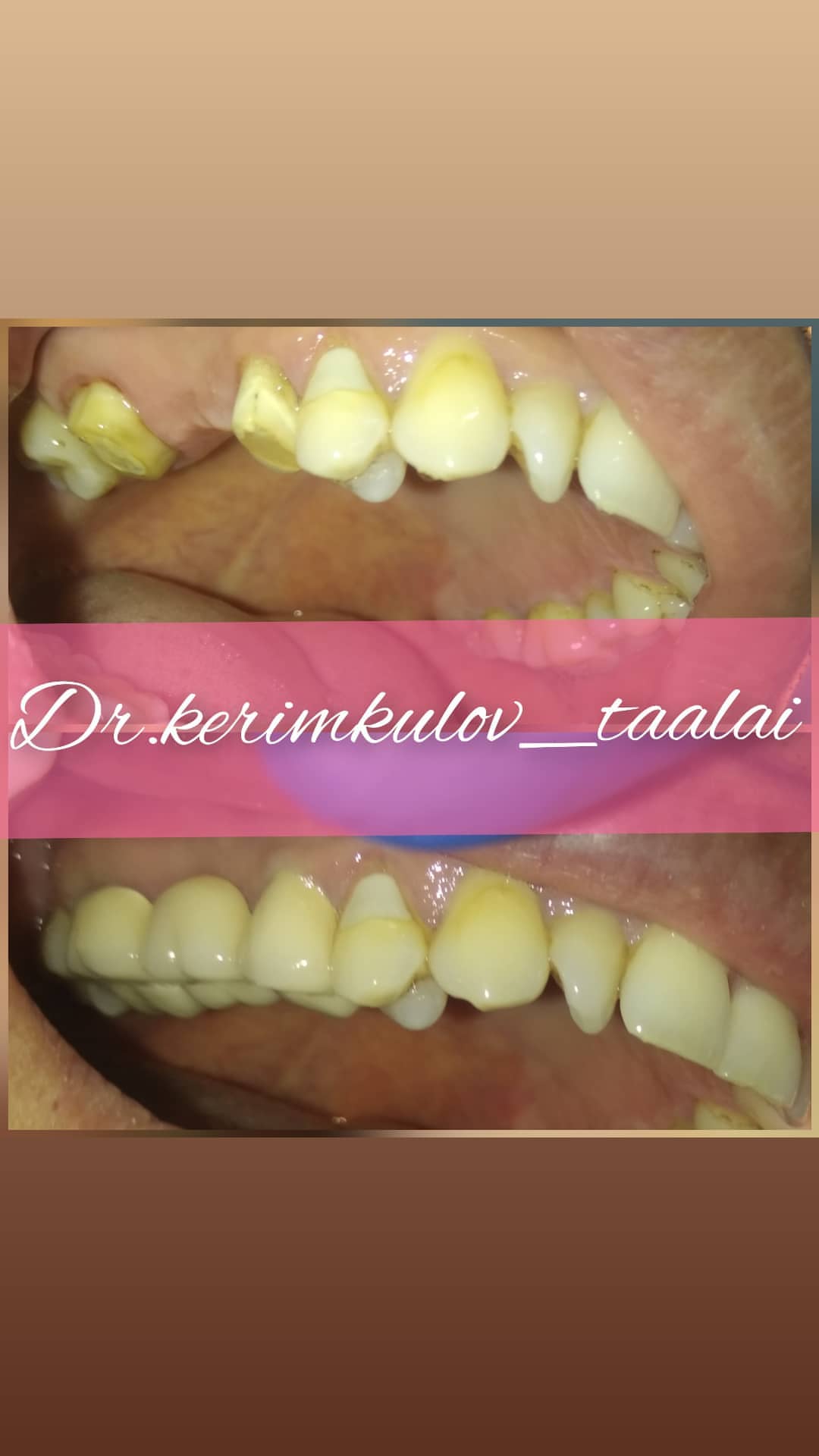 Ортопедия — результат