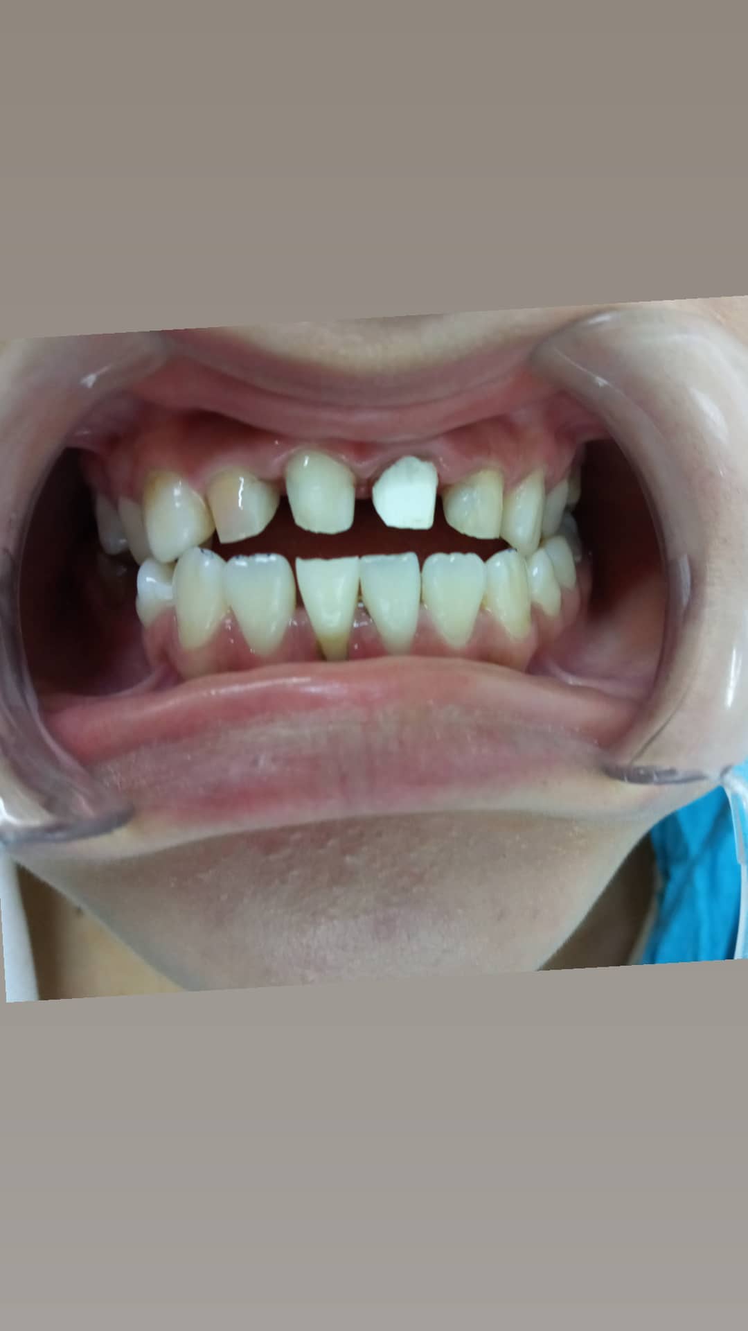 Ортопедия — результат