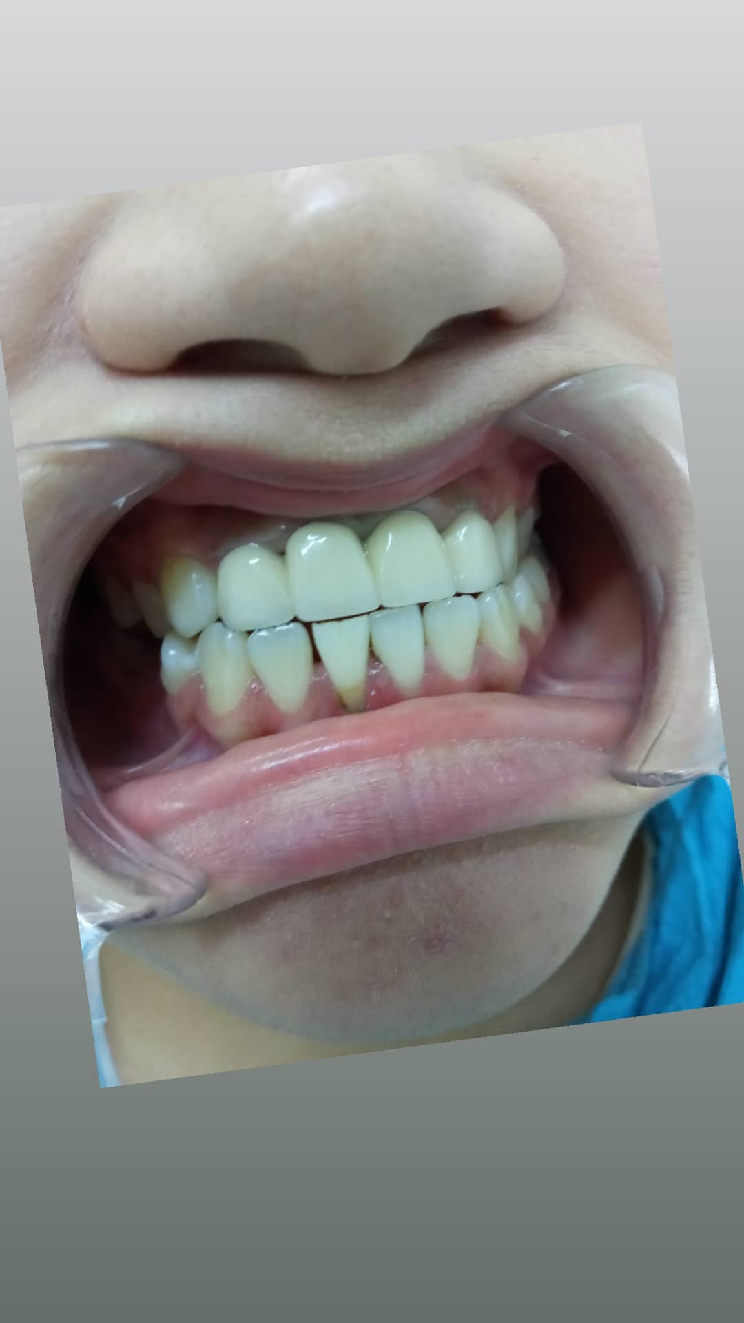 Ортопедия — результат