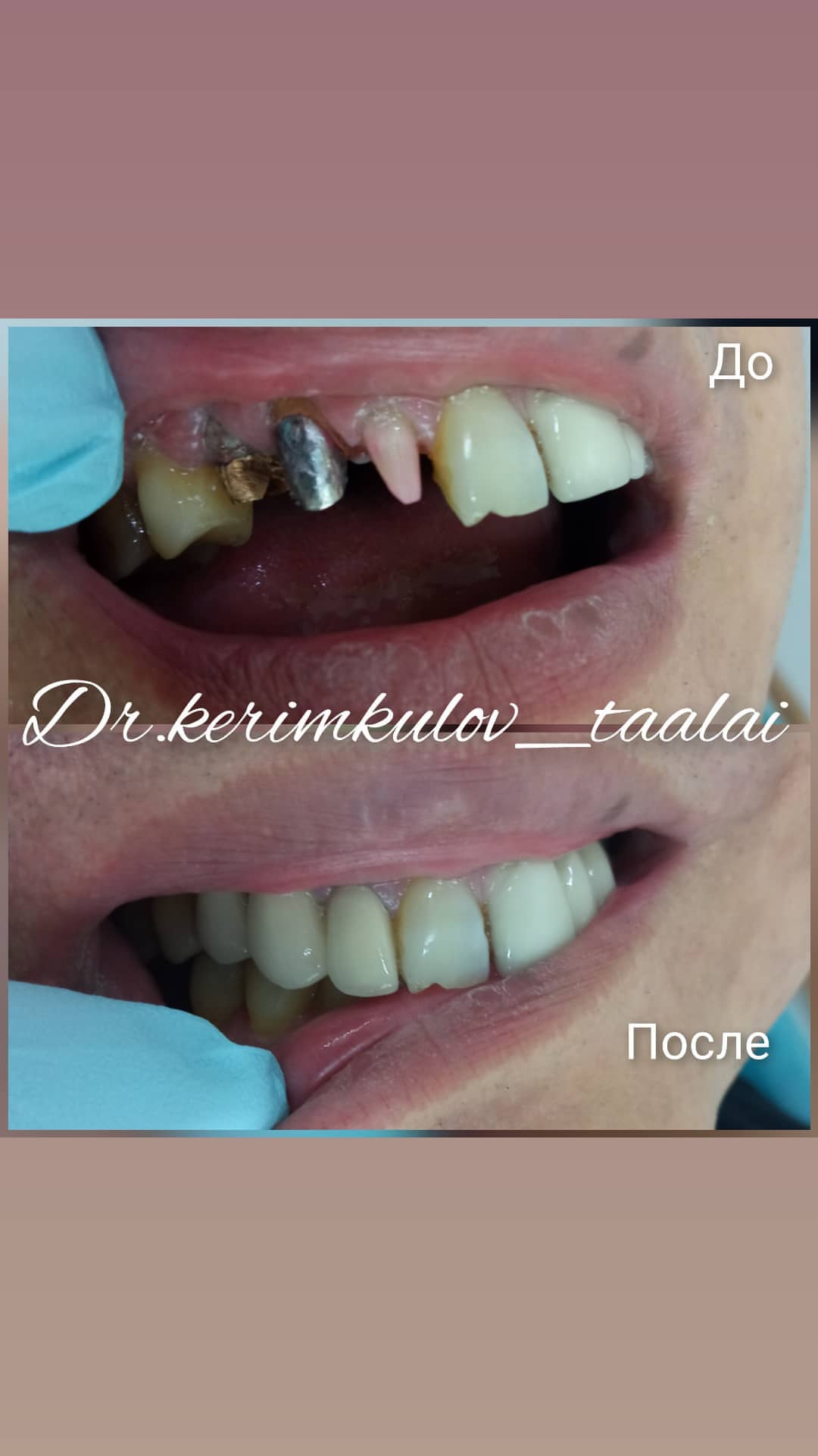 Ортопедия — результат