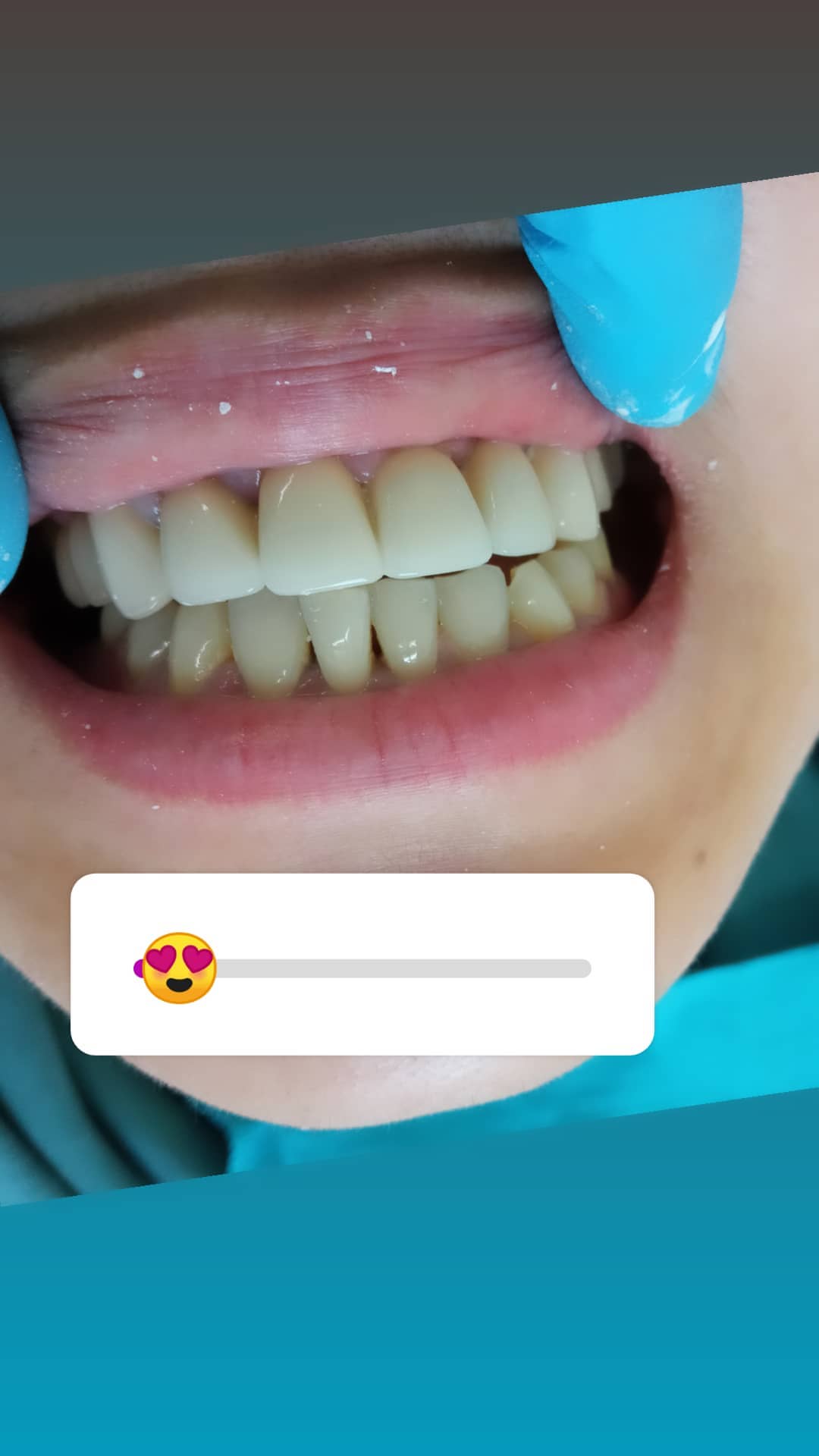 Ортопедия — результат