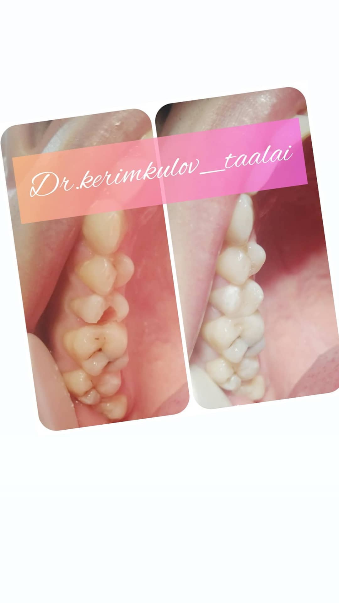 Терапия — результат