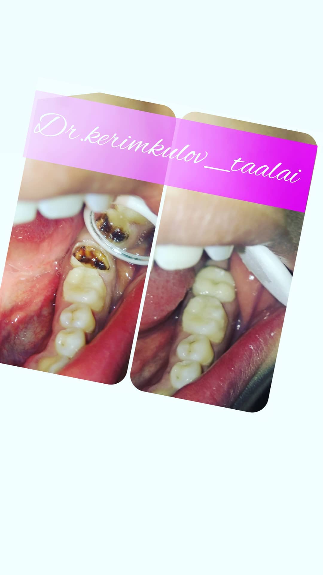 Терапия — результат