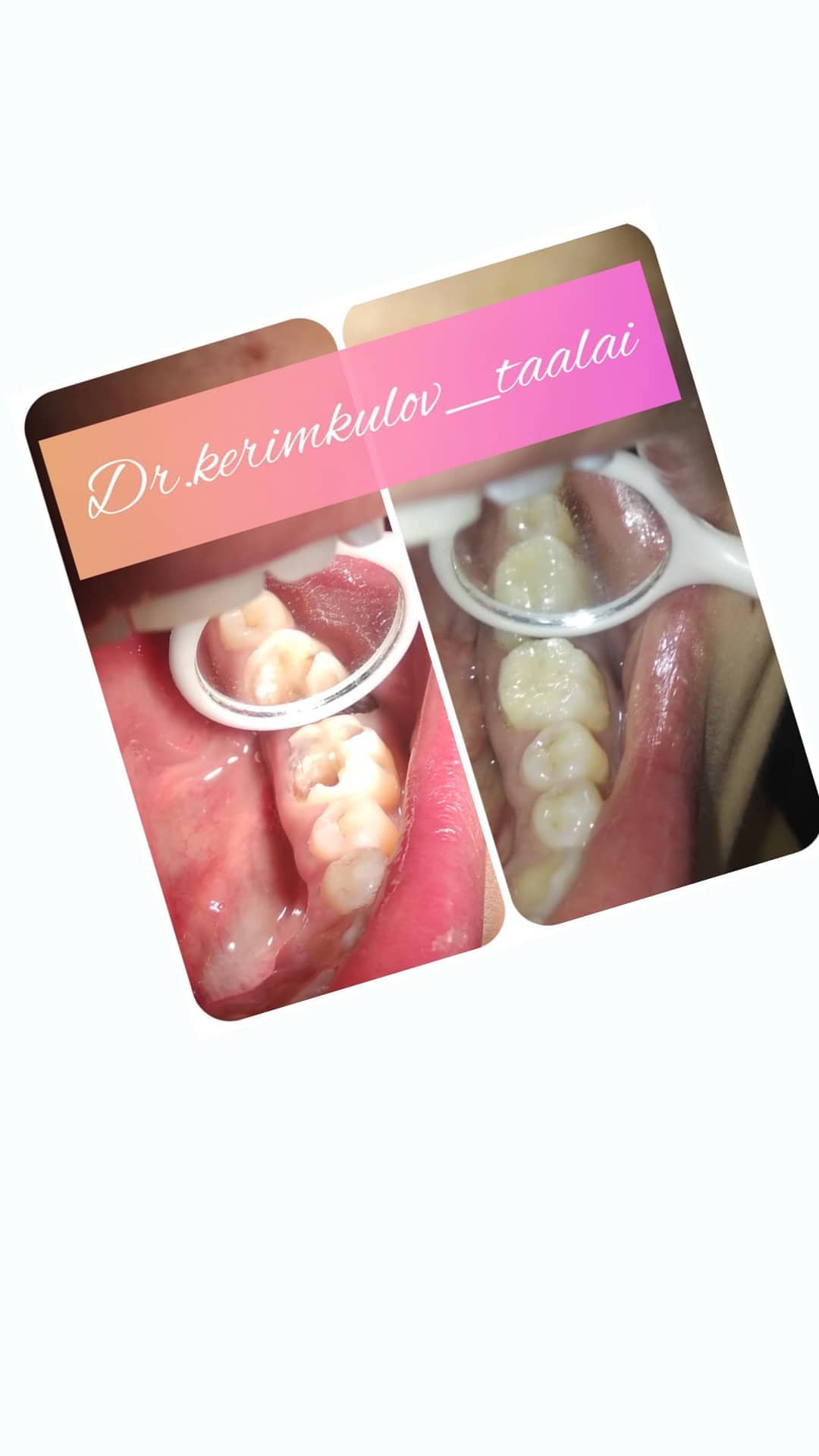 Терапия — результат