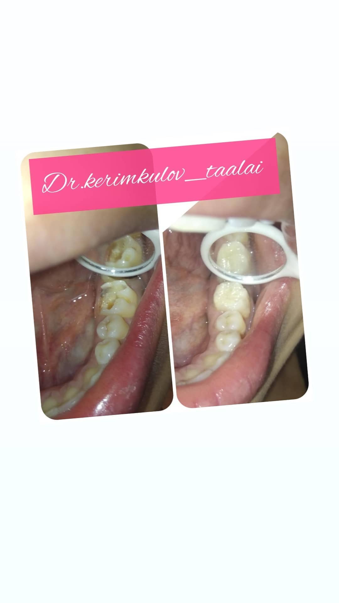 Терапия — результат