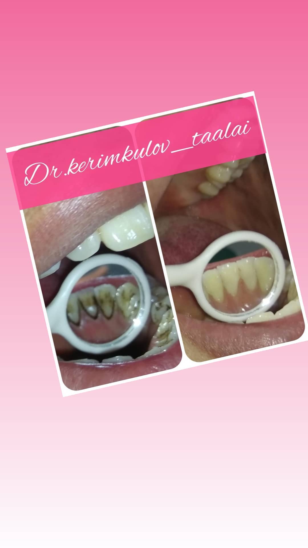 Терапия — результат