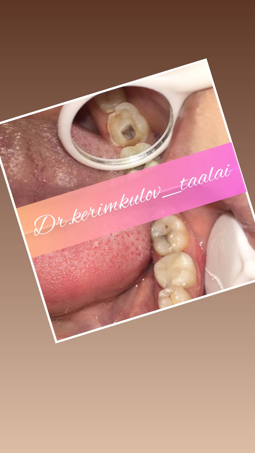 Терапия — результат