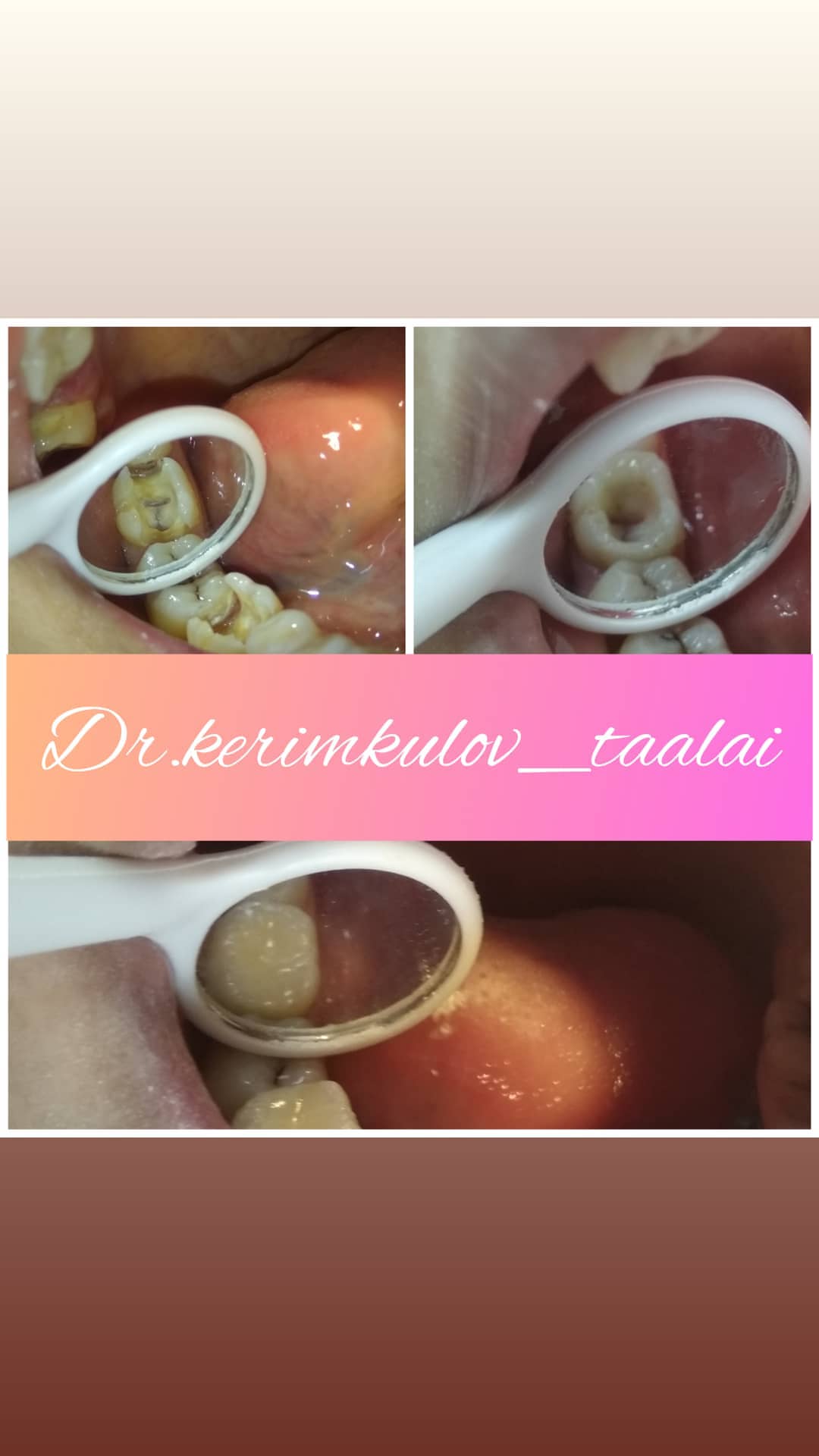 Терапия — результат